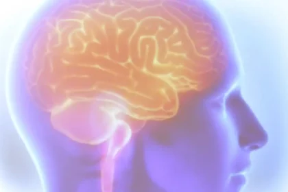 cerebro avc