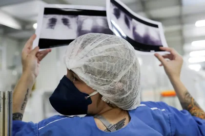 radiografia